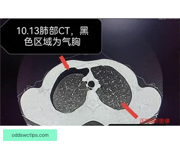 坎宁安气胸恢复顺利 活塞官方公布复查时间和复出计划
